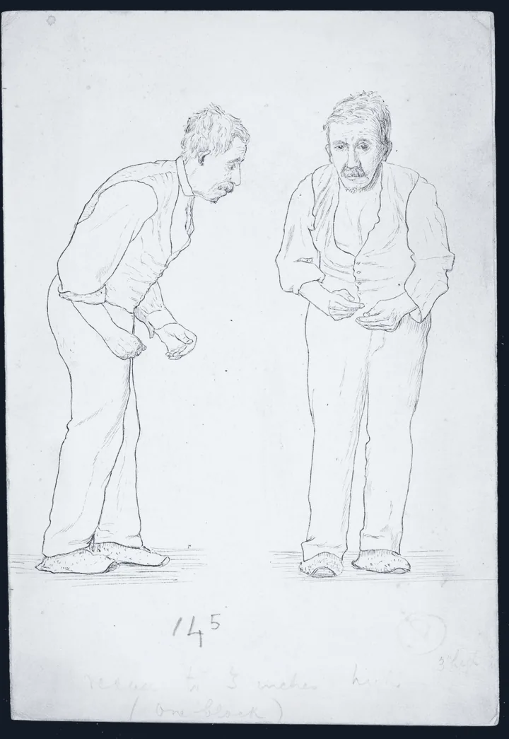Drawing of a man with Parkinson's disease from the front and the side, stooped, arms flexed